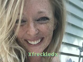 Xfreckledx